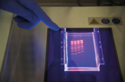 Analyse von DNA-Proben 